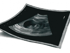 Роды в Германии как зеркало немецкой медицины